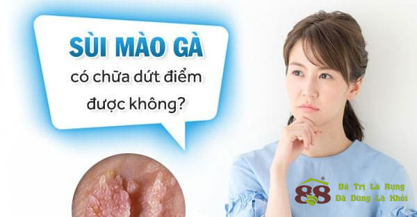 bệnh sùi mào gà có điều trị được dứt điểm không