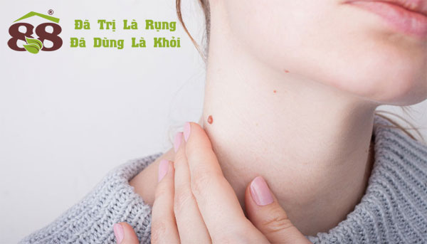 dấu hiệu sùi mào gà